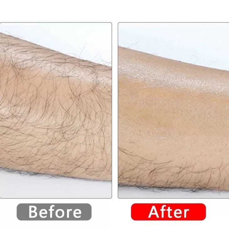 Imported™ Magical Crystal Hair Eraser [Buy 1 Get 1 Free] 😍