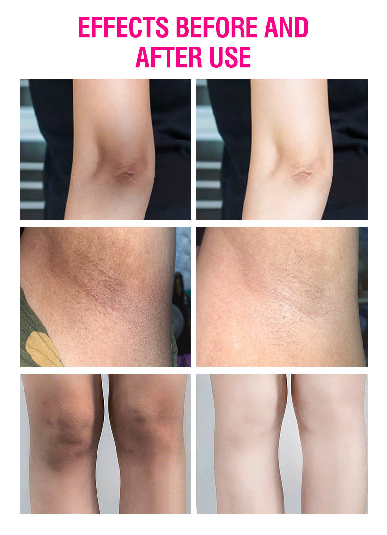 Hot Sale Milk Armpit Whitening Cream Armpit Fast Whitening Cream for Private Part