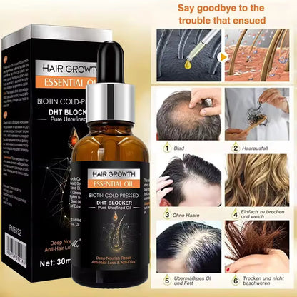 Hair Growth Oil,Biotin DHT Blocker,Anti-Loss Shampoo
