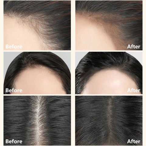 Imported™ 2 in 1 Perfect Hairline & Eyebrow Shaping Stamp [Buy 1 Get 1 Free] 🎁